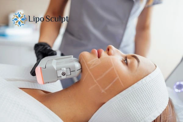 HIFU vs Botulinum Toxin: Understanding the Differences 1 HIFU vs Botox Ashby Magna What is the best option for you?