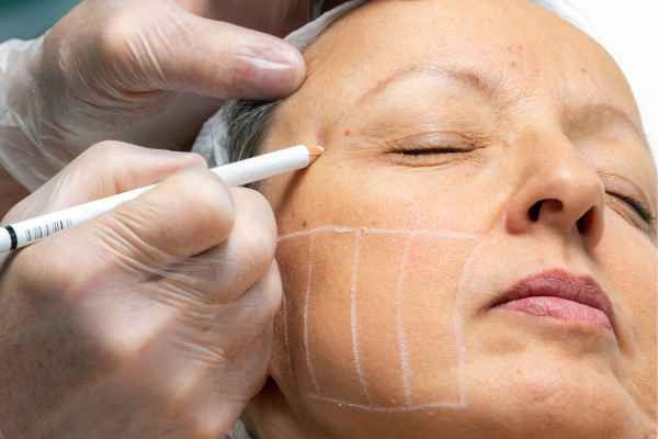 CryoPen: 5 Skin Concerns It May Be Used to Treat 4 What should you ask before having CryoPen treatment Ashby Magna?