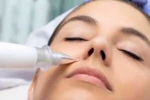 Best Actinic Keratoses Removal 3 Actinic keratoses Ashby Magna solutions - book in today!