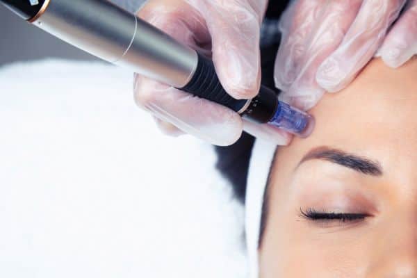 Explaining Total Skin Tightening Treatment and What to Expect 2 What Skin Concerns Can Total Skin Tightening Treatment Help With Ashby Magna?