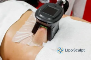 Does Fat Freezing At Home Work? 3 Fat freezing at home from Lipo Sculpt Ashby Magna